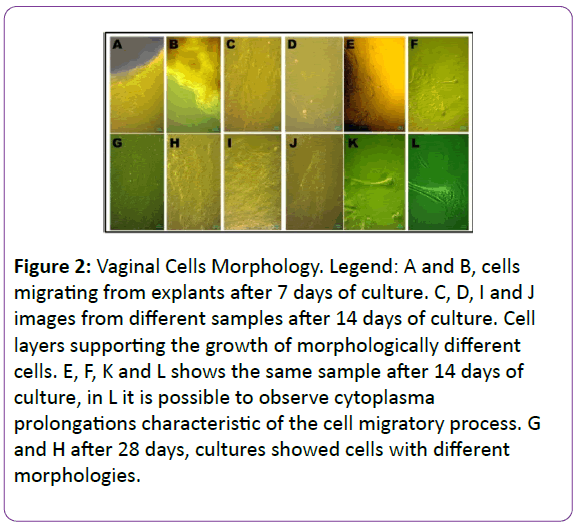 biomedical-sciences-Vaginal-Cells