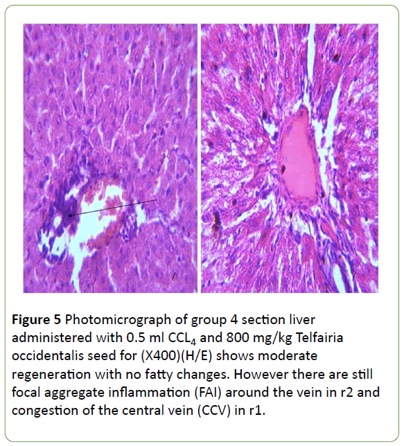 biomedical-sciences-aggregate-inflammation