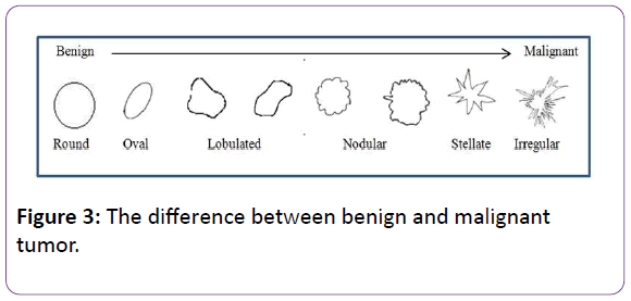 biomedical-sciences-benign-malignant