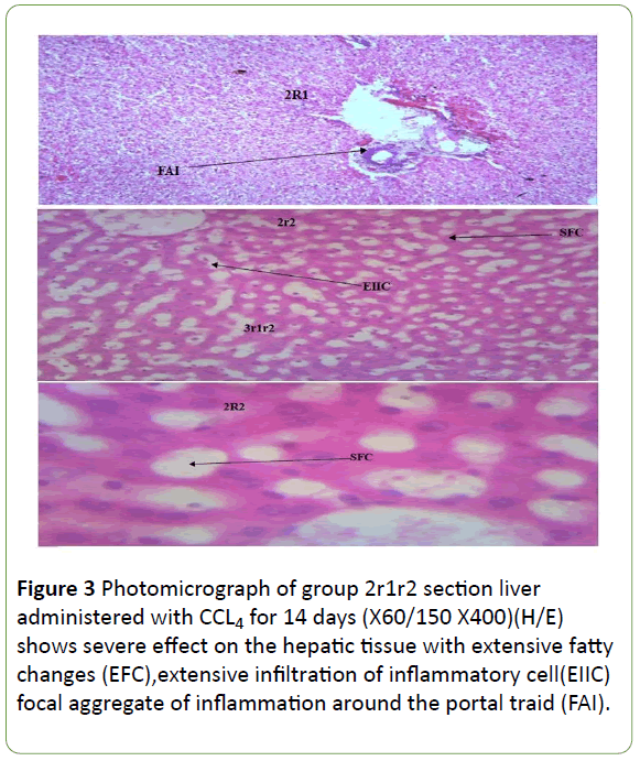 biomedical-sciences-extensive-infiltration-inflammatory