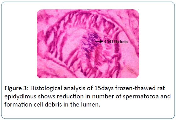 biomedical-sciences-frozen-thawed