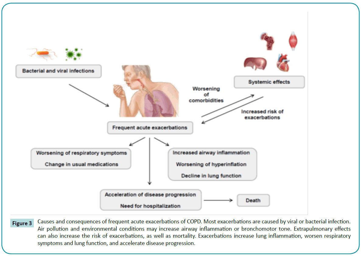 biomedical-sciences-lung-inflammation