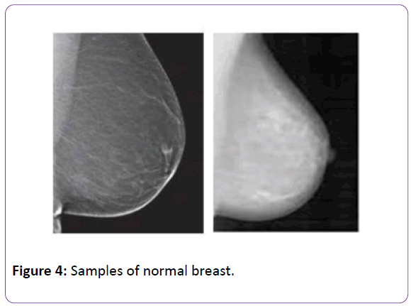 biomedical-sciences-normal-breast