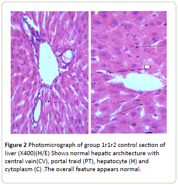 biomedical-sciences-normal-hepatic-architecture