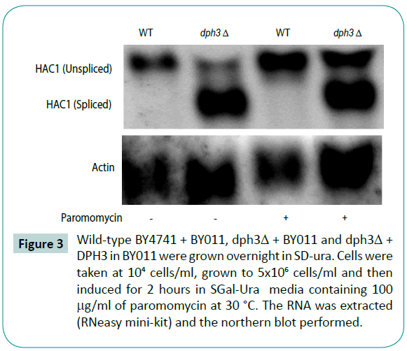 biomedical-sciences-northern-blot