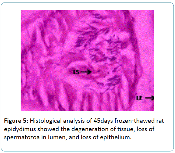 biomedical-sciences-spermatozoa-lumen