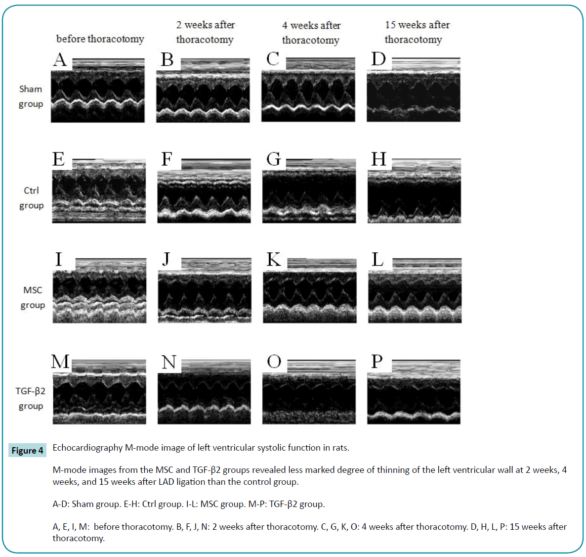 biomedical-sciences-systolic-function