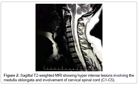 drug-development-research-hyper-intense