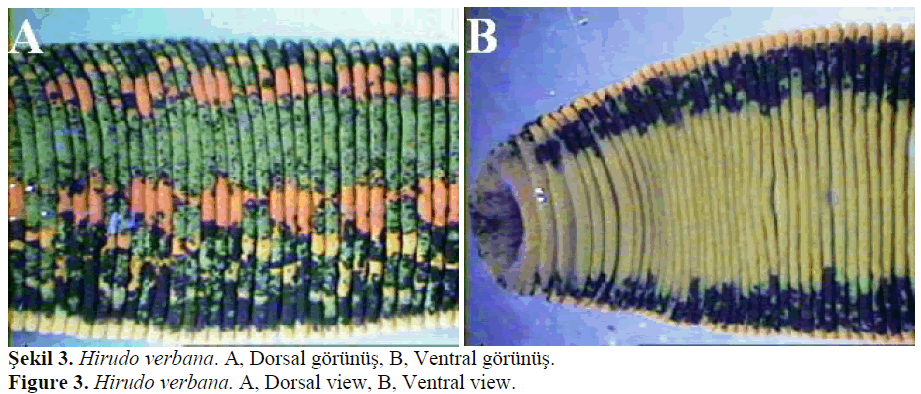 fisheriessciences-Hirudo-verbana