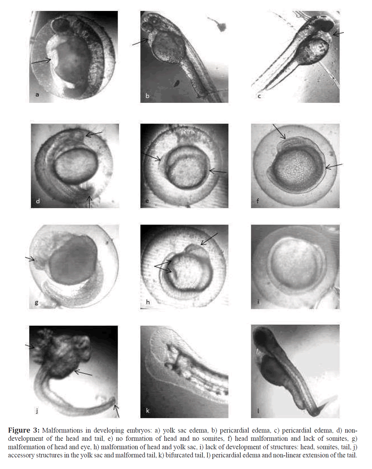 fisheriessciences-pericardial-edema