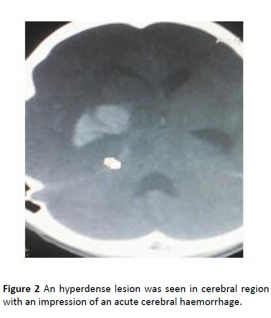 health-science-exposure-cerebral-region