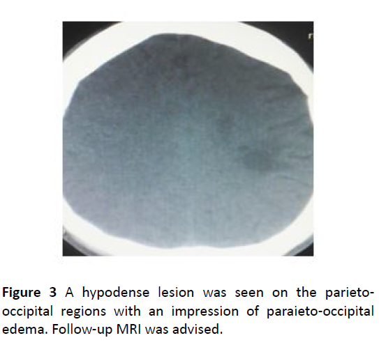 health-science-hypodense-lesion