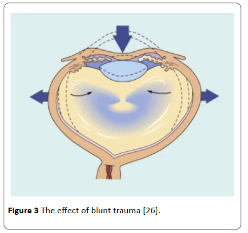 hsj-anatomy-blunt