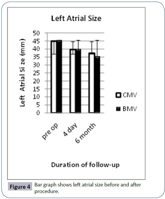 hsj-atrial-size-procedure