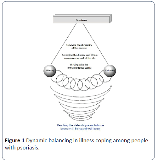 hsj-balancing