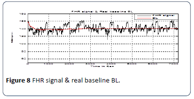 hsj-baseline