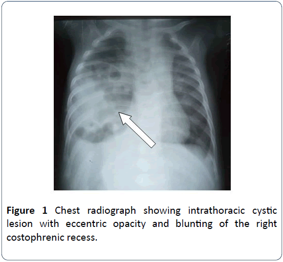 hsj-chest-radiograph-intrathoracic