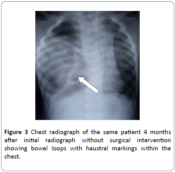 hsj-chest-radiograph-patient