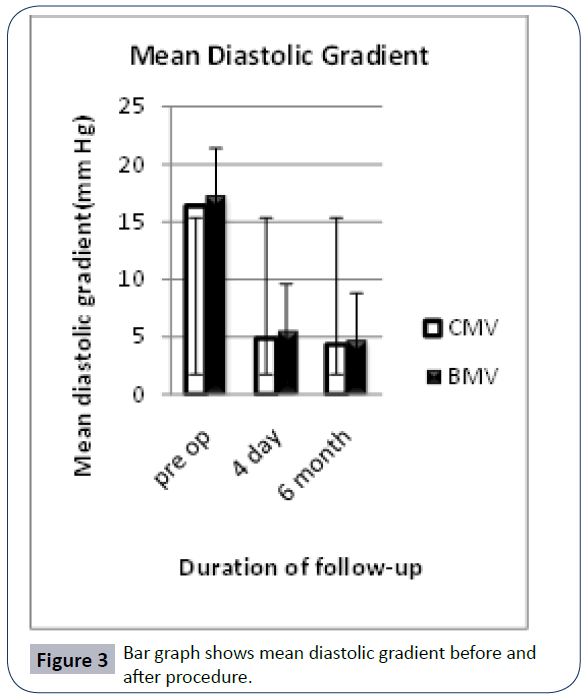 hsj-diastolic-gradient-procedure