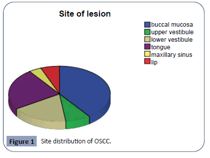 hsj-distribution