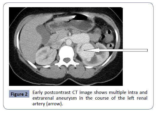 hsj-extrarenal