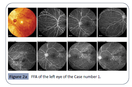 hsj-eye