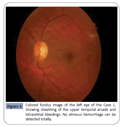 hsj-fundus