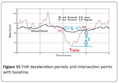 hsj-intersection