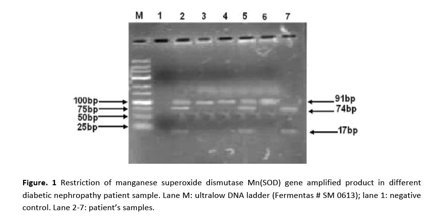 hsj-manganese-superoxide