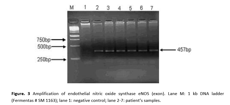 hsj-nitric-oxide-synthase