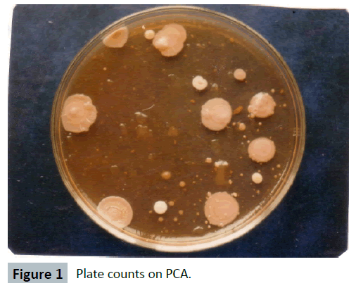 hsj-plate-counts