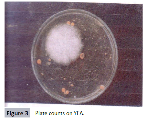 hsj-plate-counts