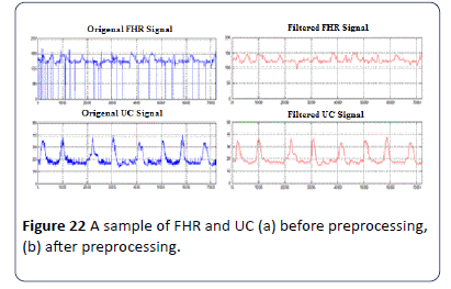 hsj-preprocessing