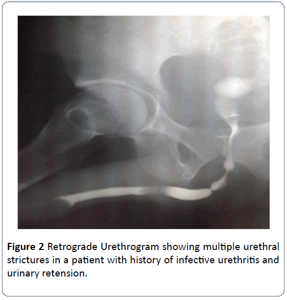 Ultrasonographic and Retrograde Urethrographic Assessment of Aeti