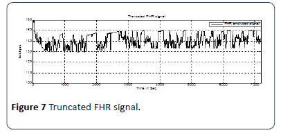 hsj-signal