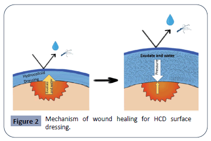 hsj-surface
