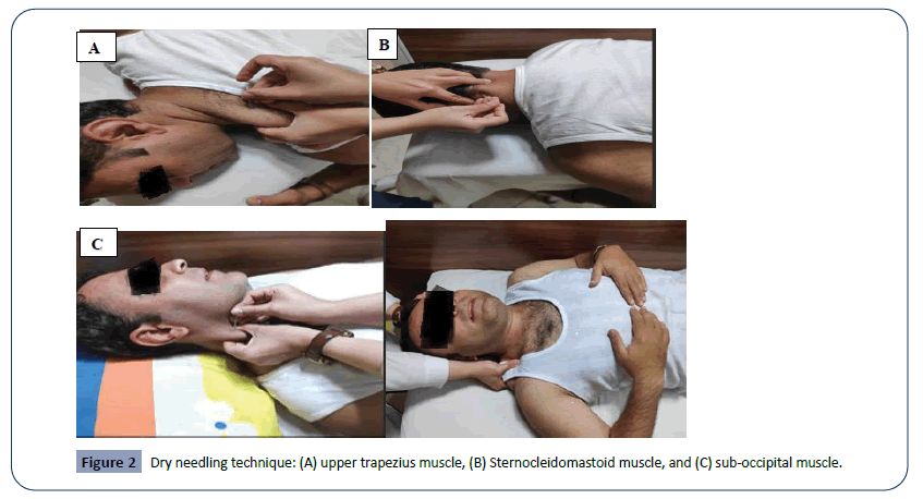 hsj-technique