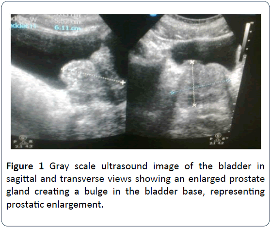 hsj-ultrasound-bladder-sagittal