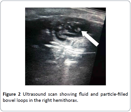 hsj-ultrasound-scan-fluid