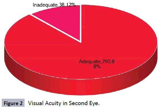 hsj-visual-acuity-eye