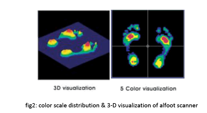 hsj-visualization-alfoot-scanner