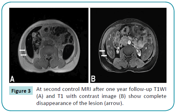 jbiomeds-control-MRI