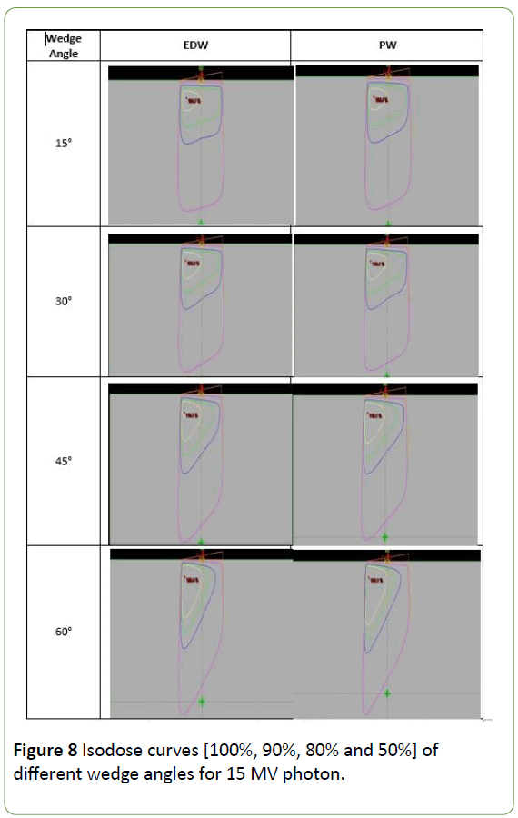 jbiomeds-wedge-angles