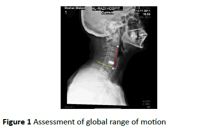 jneuro-Assessment-global