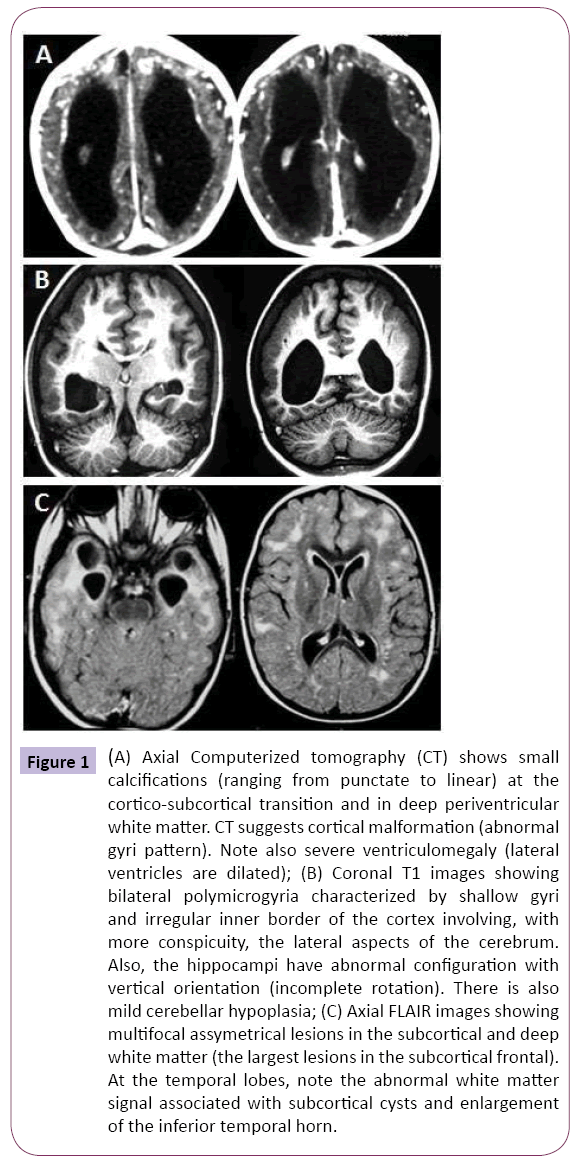 jneuro-Axial-Computerized