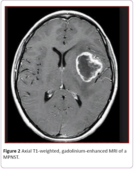 jneuro-Axial-T1-weighted