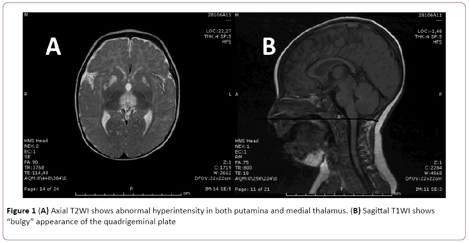 jneuro-Axial-T2WI