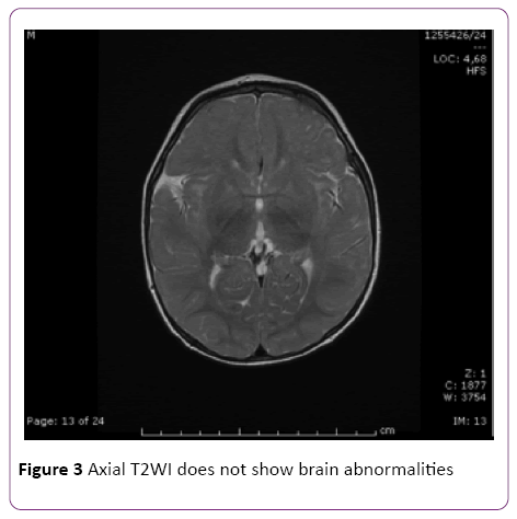 jneuro-Axial-T2WI