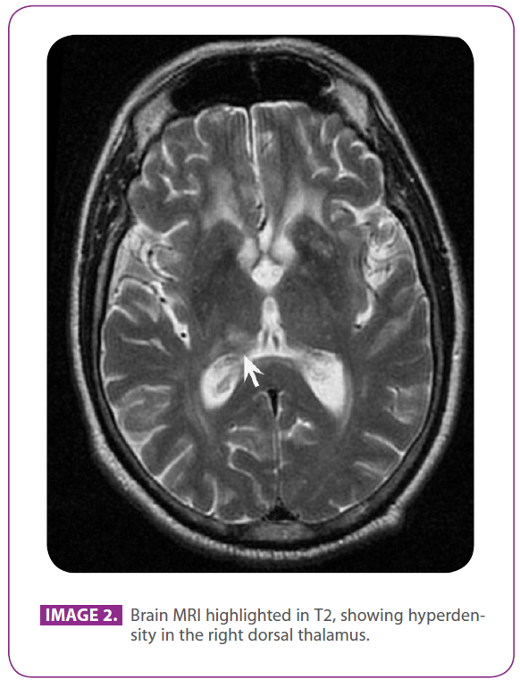 jneuro-Brain-MRI-highlighted