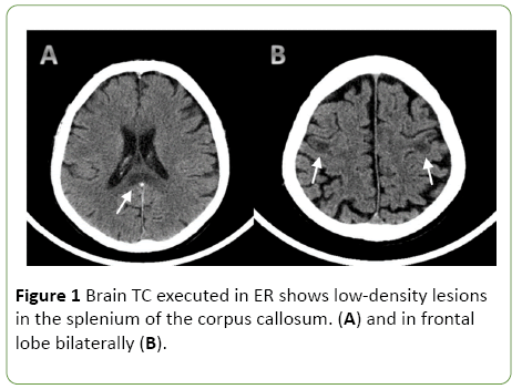 jneuro-Brain-TC